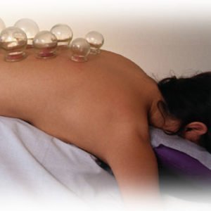 Chinese Fire Cupping