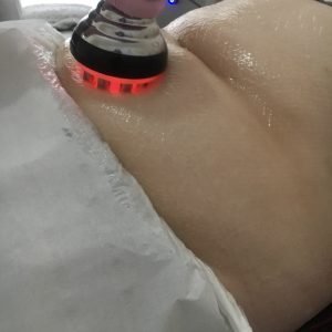 Ultrasound Cavitation and Skin Tightening (Fat Removal)