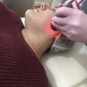 Wrinkle Reducer Facial